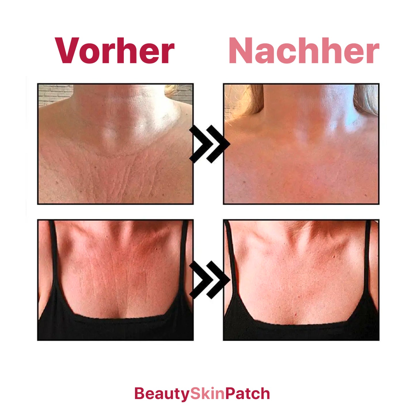 BeautySkinPatch – Für dein schönstes Dekolleté